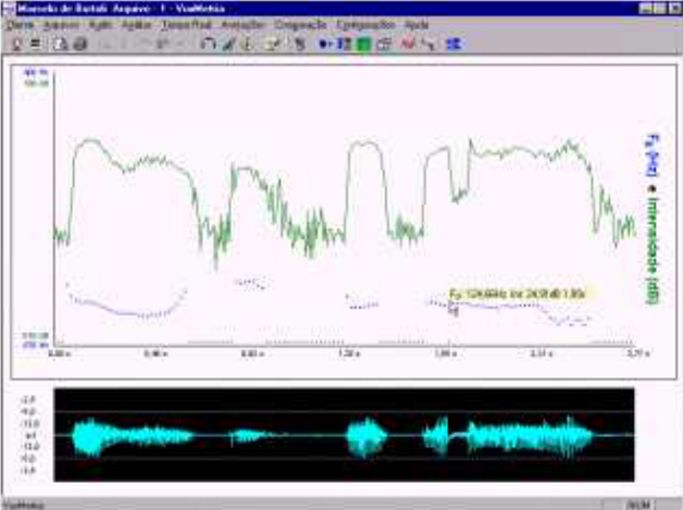VoxMetria嗓音声学参数分析软件