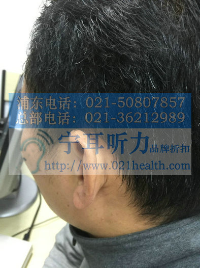 上海浦东梅园瑞声达耳道式助听器梅园哪卖瑞声达助听器