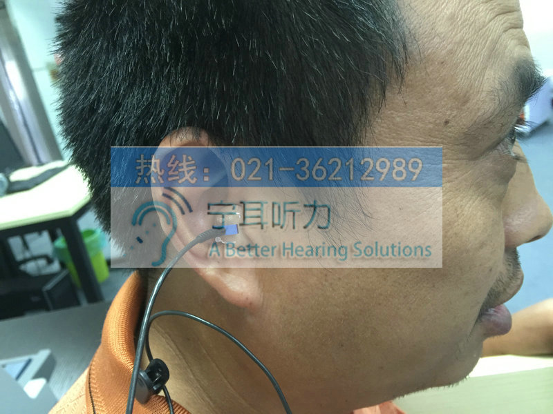 CE-标准功率达克瑞克隐形深耳道式助听器价格性能