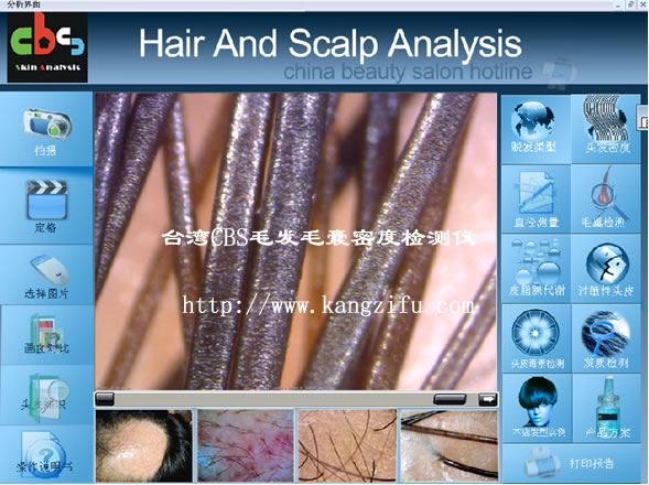 销售台湾CBS高级专业毛囊毛发密度检测仪 厂家批发