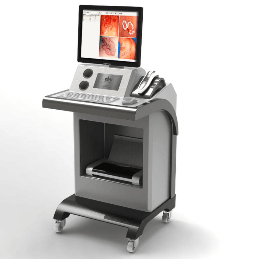 高级皮肤检测仪-CBS高级智能图像皮肤分析系统 美容整形中心专用设备
