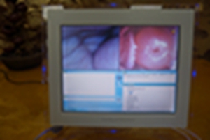 电子阴道镜检测仪 妇科检测仪子宫检测仪数码妇科阴道镜一体机