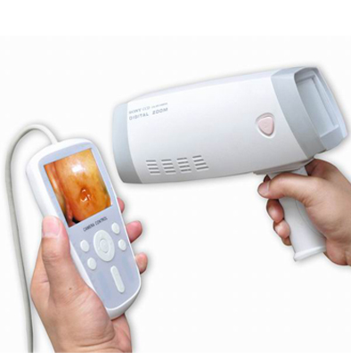 达尔邦DP-9800医用手持式电子阴道镜方便治疗