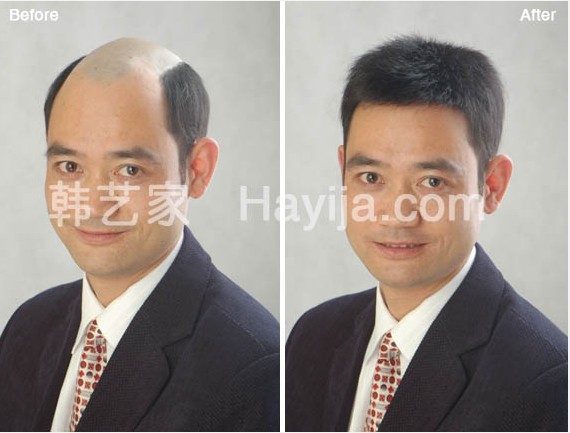 武汉韩艺家真头发量身定制的高端假发