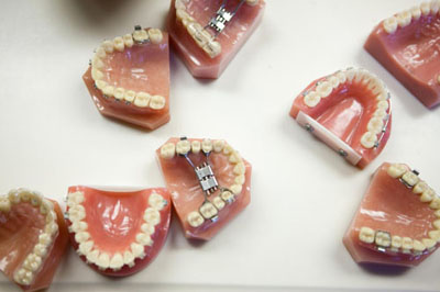 香港全口义齿 局部可摘义齿 3D 打印/设计 假牙义