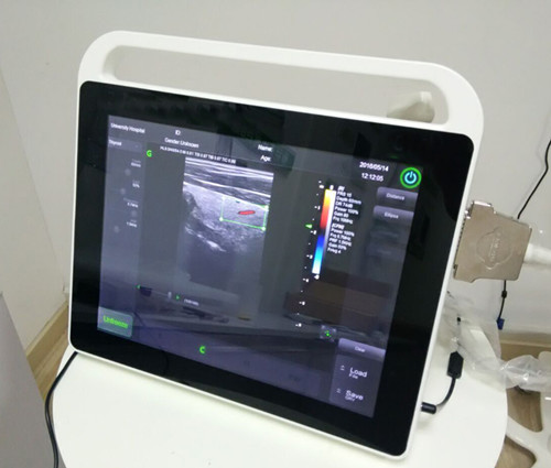 C3型触摸屏彩超便携式超声彩超机超声诊断仪